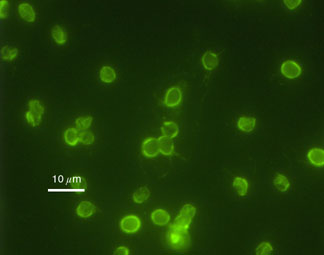 Immunofluorescence image of Cryptosporidium parvum