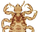 a human head louse