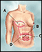 Picture of Breast Reconstruction