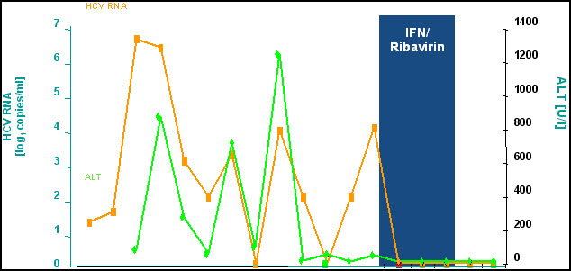 Acute hepatitis C with treatment. Rahman et al Hepatology (40): 87-97 , 2004.(Click on image to enlarge) 