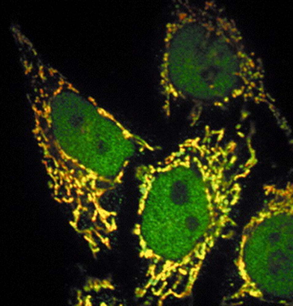 OGT isoforms are differentially targeted to nucleus and mitochondria in Hela cells