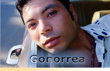 Gonorrea