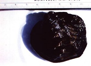 Photo of Winged Mapleleaf Mussel