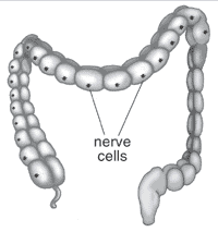 Missing nerve cells