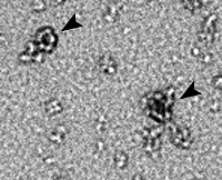 electron micrograph image of polymorphic membrane protein