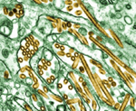 Photo of H5N1 avian flu viruses (gold) growing in animal cells (green)