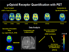 Link - to powerpoint presentation: Pain and Addiction: Can We Actually See the Relationships?