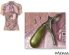 Illustration of the gallbladder