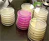Photograph of petri dishes