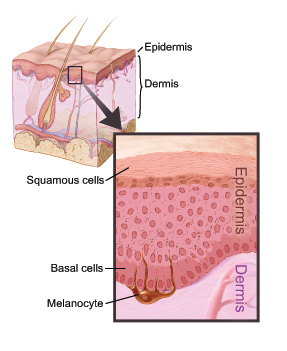 This picture shows the layers of the skin.