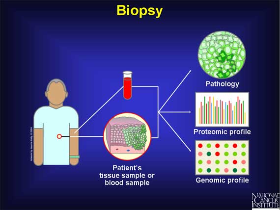 Biopsy