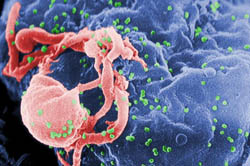 Scanning electron micrograph of HIV emerging from a white blood cell.