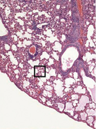 lung tissue from mice infected with pneumonia