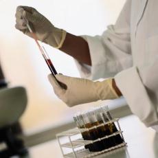 Photograph of a technician with vials of blood