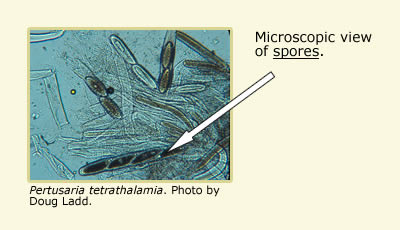 microscopic view of Pertusaria tetrathalamia spores.