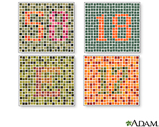 Illustration of various tests for color blindness