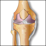 Illustration: Knee joint
