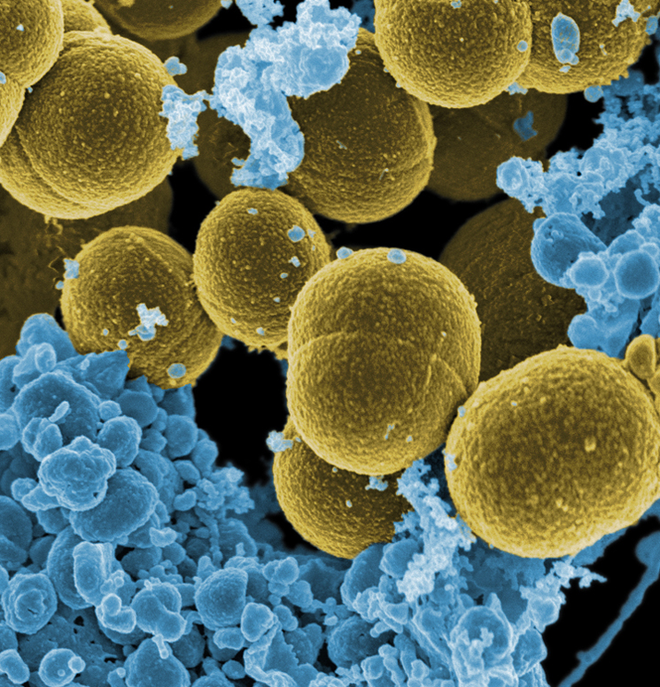 Image of S. aureus bacteria escaping destruction by human white blood cells