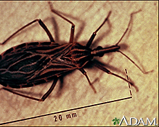 Photograph of a triatomine or kissing bug