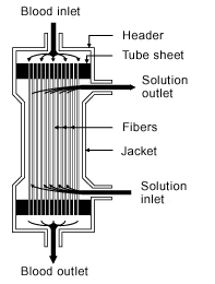 Illustration of a hollow fiber dialyzer.