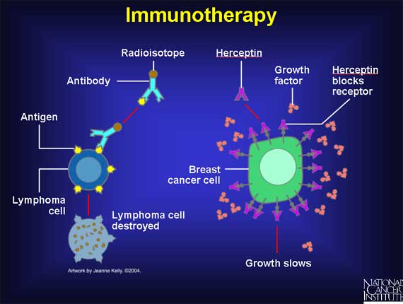 Immunotherapy