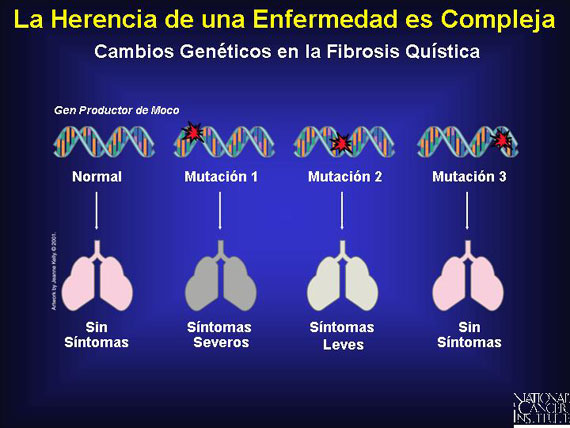 La Herencia de una Enfermedad es Compleja