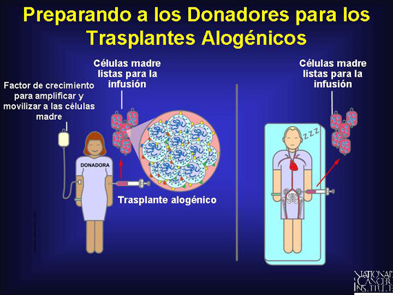 Preparando a los Donadores para los Trasplantes Alogénicos