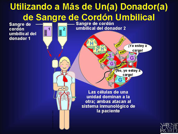 Utilizando a Más de Un(a) Donador(a) .de Sangre de Cordón Umbilical