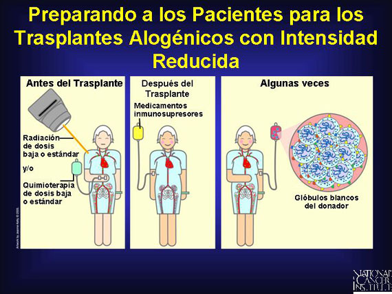 Preparando a los Pacientes para los Trasplantes Alogénicos con Intensidad Reducida