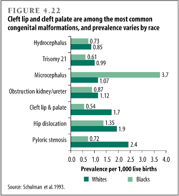 Cleft lip and cleft palate are among the most common congenital malformations, and prevalence varies by race