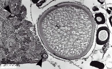 Abnormal fish gonad with egg and sperm