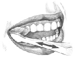 Illustration of brushing teeth at an angle.