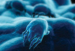 A microscopic view of dust mites.