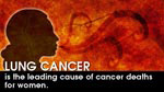 eCard: Lung cancer