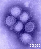 Outbreak of Swine-Origin Influenza A (H1N1) Virus Infection --- Mexico, March--April 2009