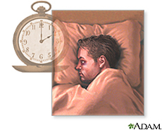 Illustration of a man with sleeping problems