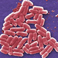 E. coli 0157:H7. Courtesy of the CDC.