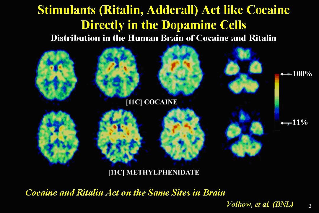 Stimulants (Ritalin, Adderall) Act Like Cocaine Directly in the Dopamine Cells