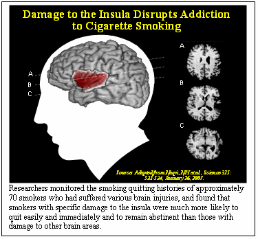 Damage to the Insula Disrupts Addiction to Cigarette Smoking
