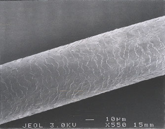 Figure 9 is a photomicrograph of scale pattern (human).