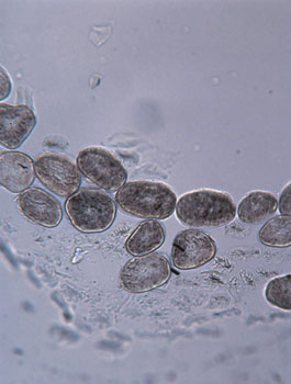 Figure 24 is a photomicrograph of cross-section of Caucasian hair.