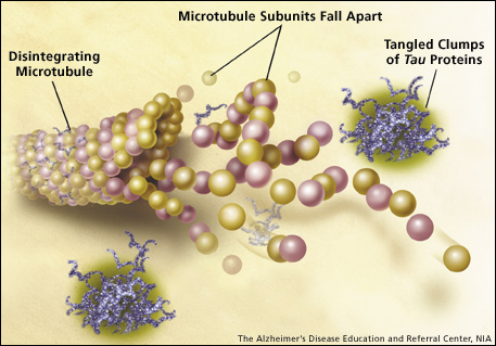 Illustration showing tangled clumps of Tau Proteins, which resemble tangled pieces of yarn, and a disintegrating microtubule, which looks like beads woven together with yarn that are pulling apart.