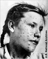 Close-up of girl with scarred face (U.S. National Archives)