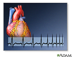 Ilustración de un corazón y un electrocardiograma del ritmo cardíaco