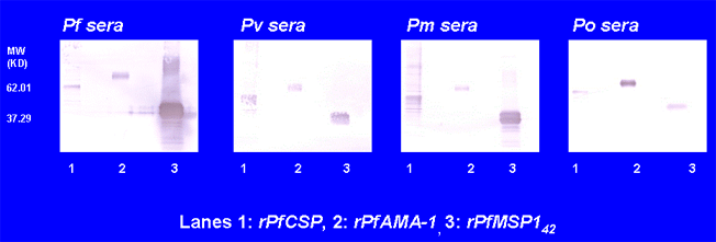 Cross-species recognization of recombinant P. falciparum antigens with sera from P. falciparum, P. vivax, P. malariae 
and P. ovale infected patients by western blot