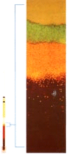 The Quantitative Buffy Coat (QBC) Test