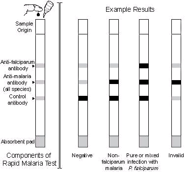 Antigen Detection Tests for Malaria