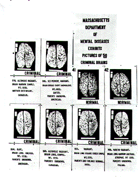 The Brains of Criminals