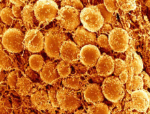 Globular fat cells.