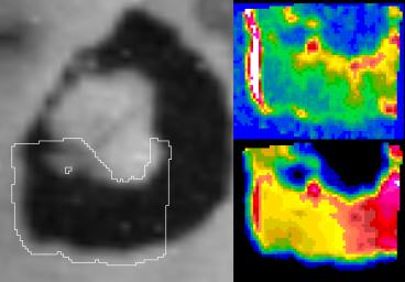 Io's Loki in Infrared: Hot Edge